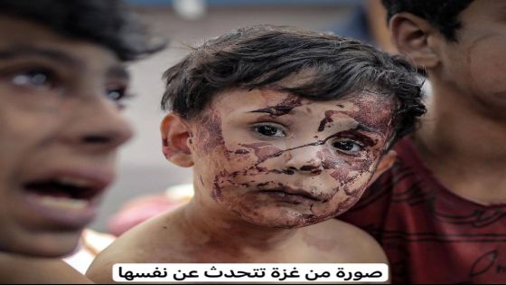 الصورة تتحدث عن نفسها من غزة